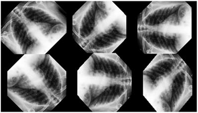 Artificial intelligence in the healthcare sector: comparison of deep learning networks using chest X-ray images